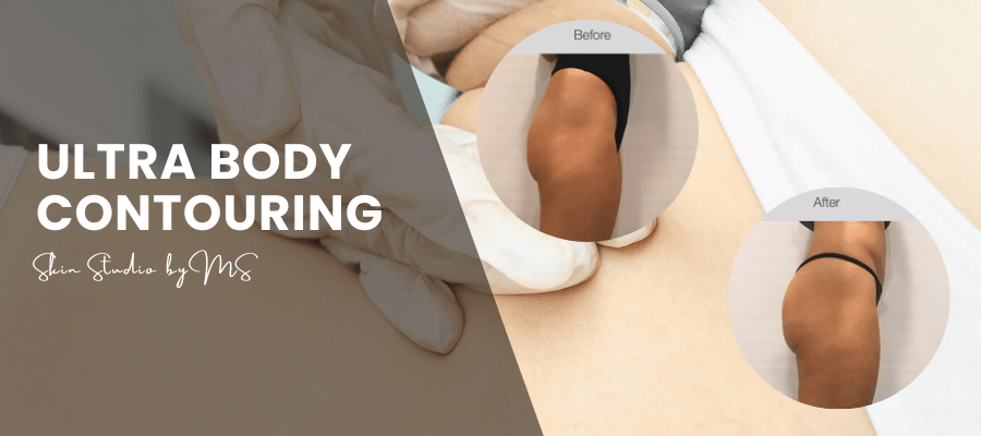 Ultra Body Contouring – SkinStudiobyMS